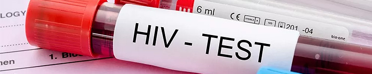 Анализы на ВИЧ в Измайлово